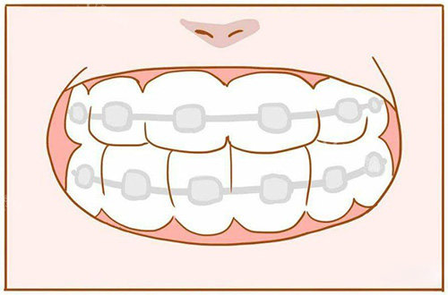 南通做牙齿修复哪家好？这几家医院做牙齿修复的技术娴熟且成效好！(图4)