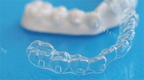 达芬奇隐形牙套怎么样？价格收费／牙齿矫正特点／佩戴优势一文全了解！(图2)