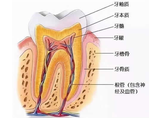 桐庐县洁诚口腔根管治疗卡通图