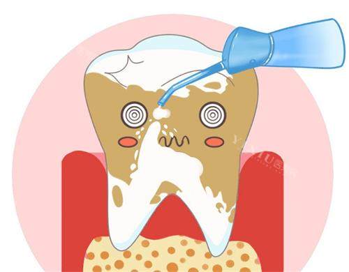 护牙分享！为您解答邻水县洗牙去哪好？苗苗／邵颖／春雨等技术和服务兼备(图3)