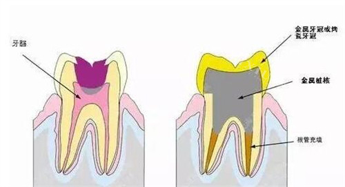 廉江牙科哪家收费合理？佳雅／尚美／齐贝口腔等是靠谱机构，性价比高！(图2)
