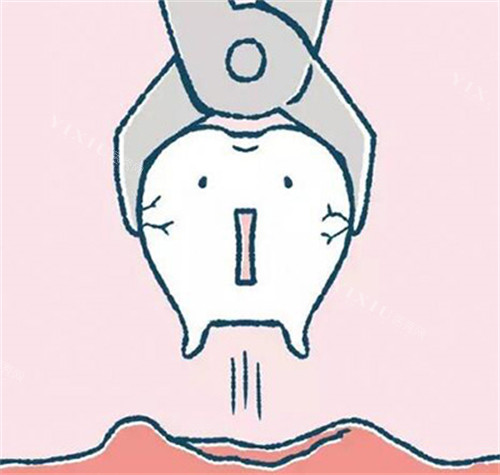 廉江牙科哪家收费合理？佳雅／尚美／齐贝口腔等是靠谱机构，性价比高！(图3)