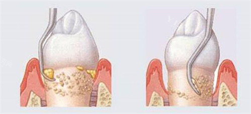 黄江看牙齿去哪个医院？这十家是必选机构，有牙病问题安心改善！(图4)