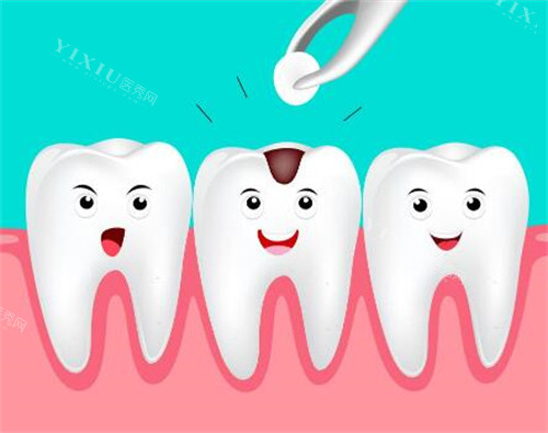 湛江补牙多少钱一颗牙？200-800元左右！补牙材料｜位置不同收费有差！(图3)