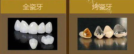 把牙磨小了做烤瓷牙好吗，分享戴牙冠的后遗症和弊端！(图5)