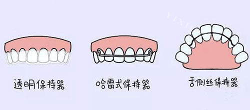 牙齿矫正正畸保持器