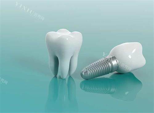 本溪种植牙哪个医院比较好？整理了一份本溪种植牙技术好的五家正规口腔医院(图1)