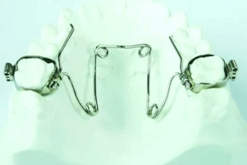 公开！扩弓器矫正牙齿的较佳年龄，据查询8-18岁戴扩弓器适合，附扩弓器矫正牙齿的好与坏(图3)