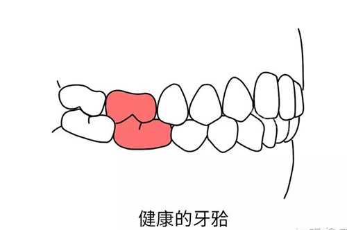 正颌改善图展示