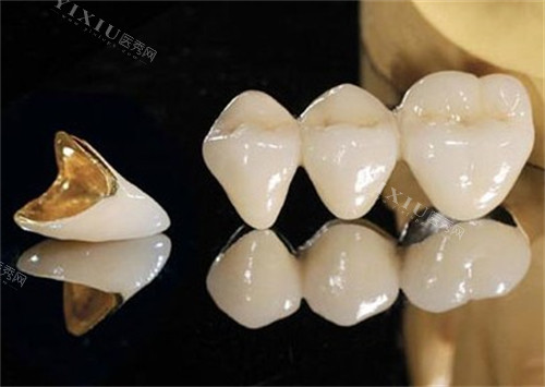 大门牙歪了怎么矫正？带你了解门牙歪了的解决办法，多种矫正方式哪种更好更适合？(图3)