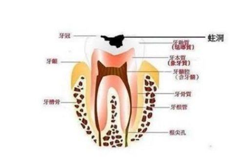 警惕！8个症状说明已有牙髓炎，怎样确定是不是牙髓炎，看牙髓炎有什么症状出现(图4)