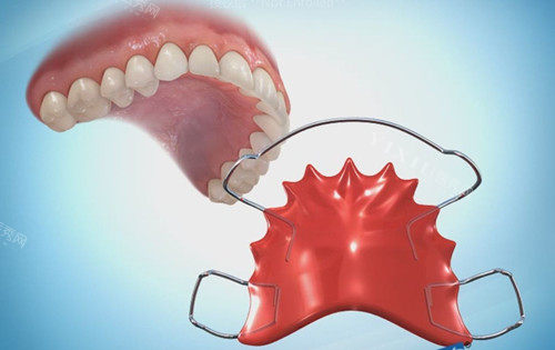 保持器丢了几天会反弹？情况因人而异！建议尽快到院补做避免牙齿反弹！(图1)