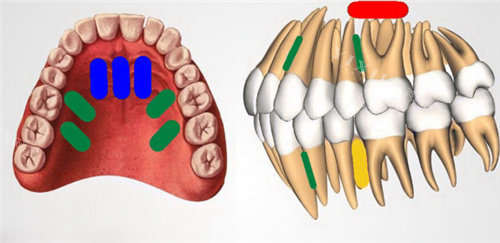 更新啦！2024后半年遂宁牙科项目价目表：矫正12000+／缺损修复255+／牙周治疗百元起(图3)