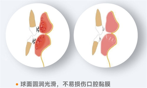 欧睛球托舒适度高