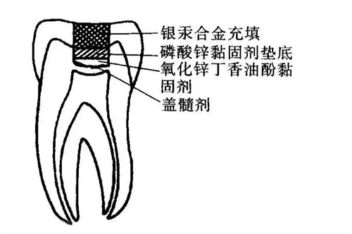 盖髓术改善部位展示图