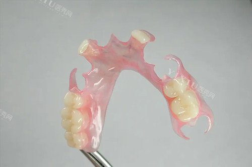 详解吸附式假牙的优点和缺点，舒适易清洁但需要适应期！(图4)