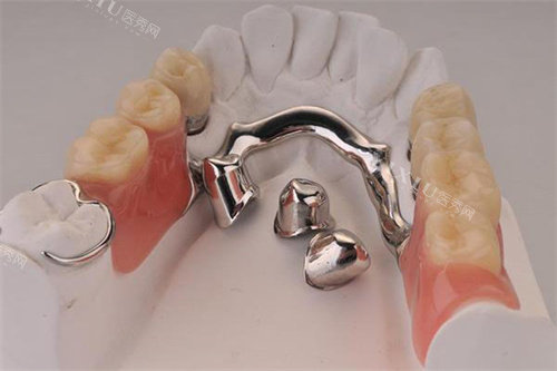 详解吸附式假牙的优点和缺点，舒适易清洁但需要适应期！(图5)