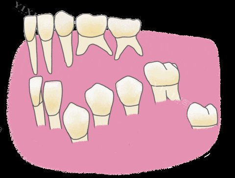 肇庆儿童牙科收费标准表：48-14800元不等！儿童涂氟／窝沟封闭／补牙／早期正畸多项收费！(图1)