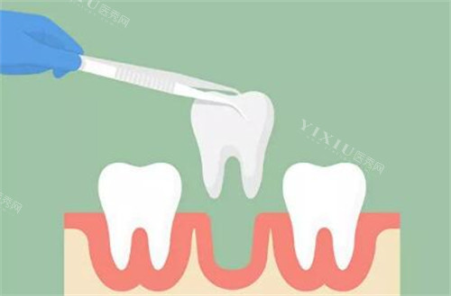 曙光美云口腔收费价目表：洗牙69.9+／补牙200+／拔牙100+／种植牙1380+／牙齿美白1500+(图1)