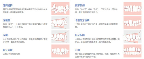 牙齿畸形的不同症状