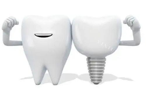 悦锆种植体与瑞锆的区别介绍：材料、外观、技术、价格上有一些区别！(图3)