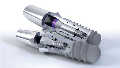 Straumann implant