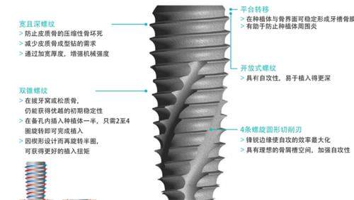 韩国柯威尔种植牙介绍