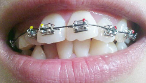 延吉正畸医院哪家好啊？公布一份延吉正畸口碑好的口腔医院合集！(图1)