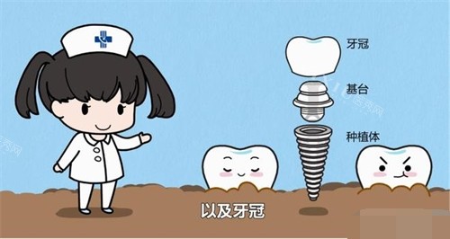 延吉种植牙哪家医院好？公布延吉价廉物美的种植牙医院汇总！(图1)