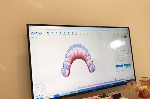 温州爱牙故事口腔牙齿矫正方案设计