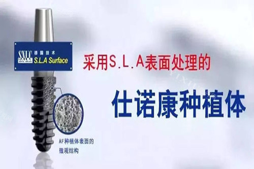 韩国仕诺康种植牙是杂牌子吗？不仅不是而且还是韩系高人气进口植体之一哦｜内附型号参考(图3)