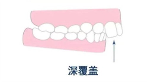 深履合是什么