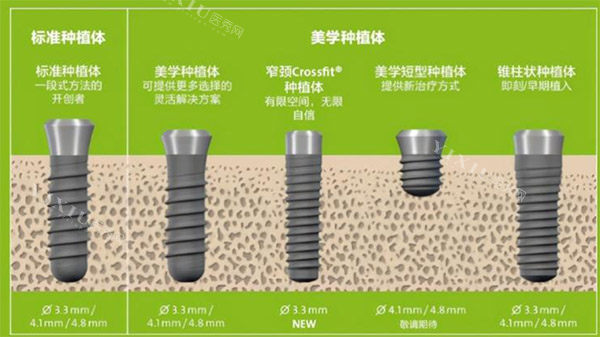 种植体规格种类参考图