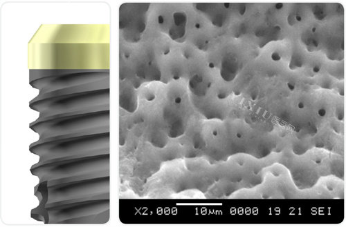 瑞士百丹特种植牙表面工艺放大