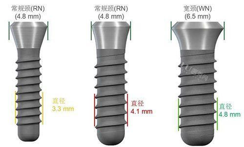 种植牙尺寸规格种类图