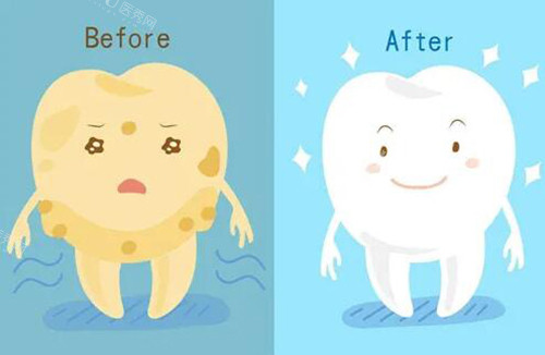 蚌埠皓芽口腔收费标准：洗牙68+／种牙2980+／矫正6780+／补牙158+／拔智齿280+／全瓷牙988+(图3)