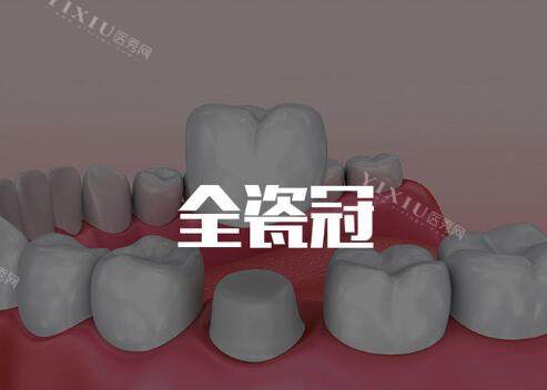 全瓷冠修复改善