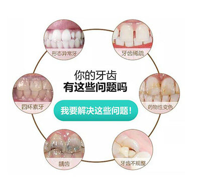 哪些牙齿需要做牙冠