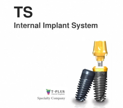 瑞士T-PLUS种植体宣传介绍