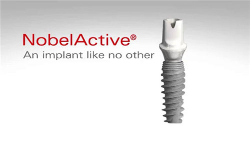 瑞典诺贝尔Active与金致的主要区别：主要体现在表面处理技术、性能和价格等方面-医秀网