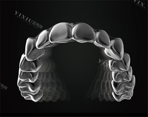 美立刻隐形牙套图示