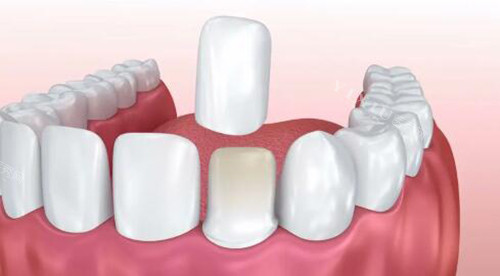 重庆东南医院口腔科24小时预约电话023-688！详细地址／到院路线／乘车方案齐全揭秘！(图1)