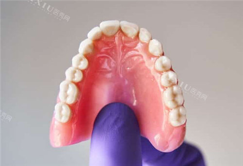 钢托义齿戴着舒服吗？和胶托义齿相比都有哪些特点？(图2)