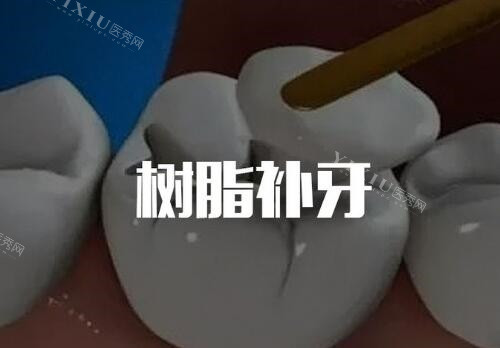 树脂补牙卡通