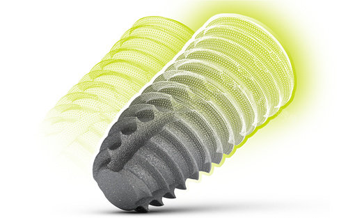 韩国奥齿泰和瑞士ITI种植体哪个好？从它们的材料、技术、价格等方面来看！(图4)