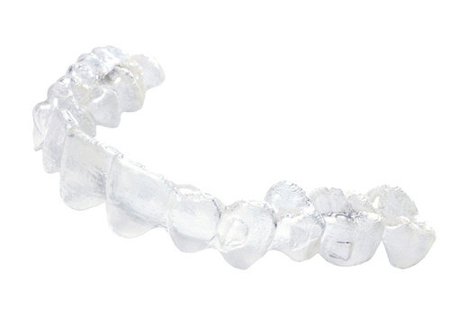 讲述我 36 岁做完隐适美矫正的感受，戴隐形牙套不后悔呀(图2)