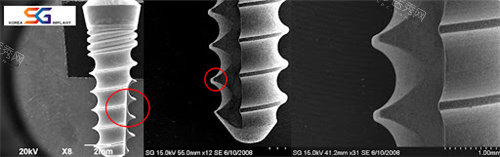 韩国SG种植体局部放大