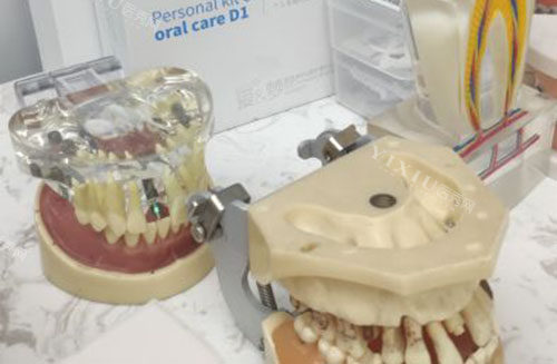 防城港健安口腔牙齿模型展示