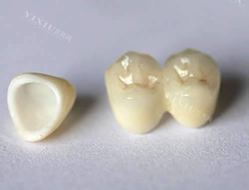 钦州人和口腔牙冠材料