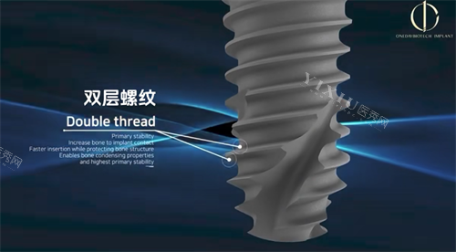 韩一种植体螺纹设计